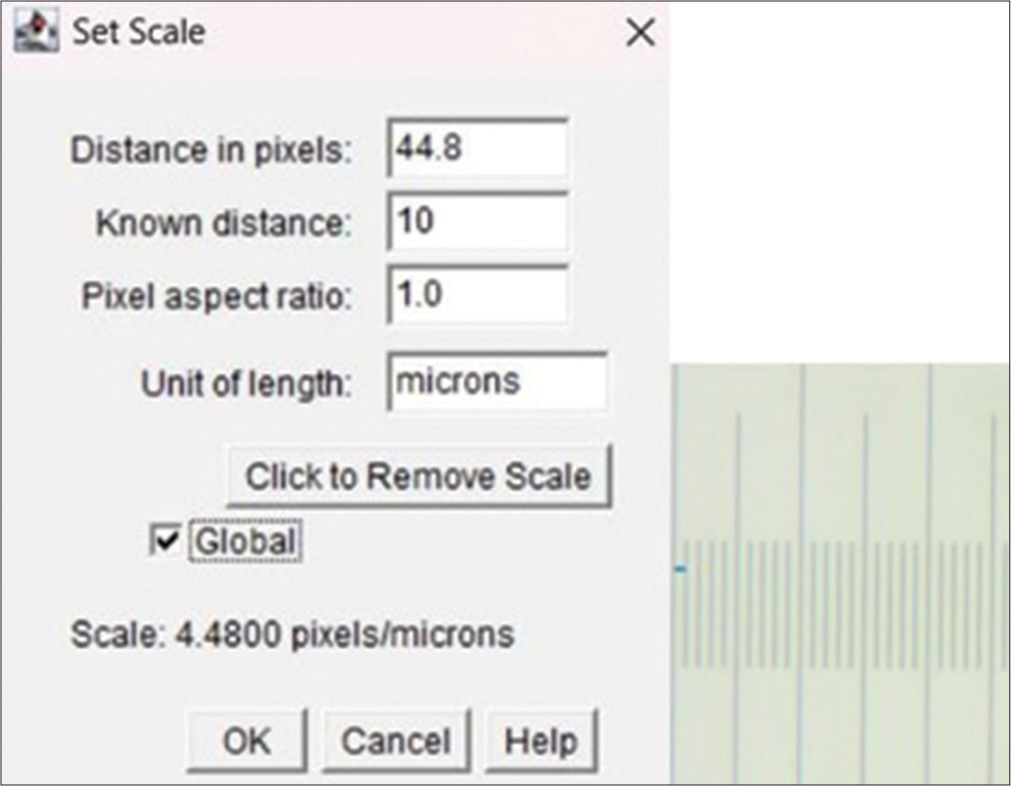 Set scale for (×40) magnification and calibration using set scale straight line selection tool.