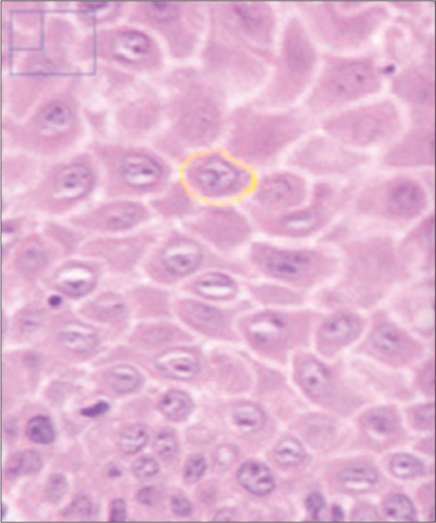 Measurement of cell area. Five random cells with clear outline from each of the five fields were traced in spinous cells and measured.