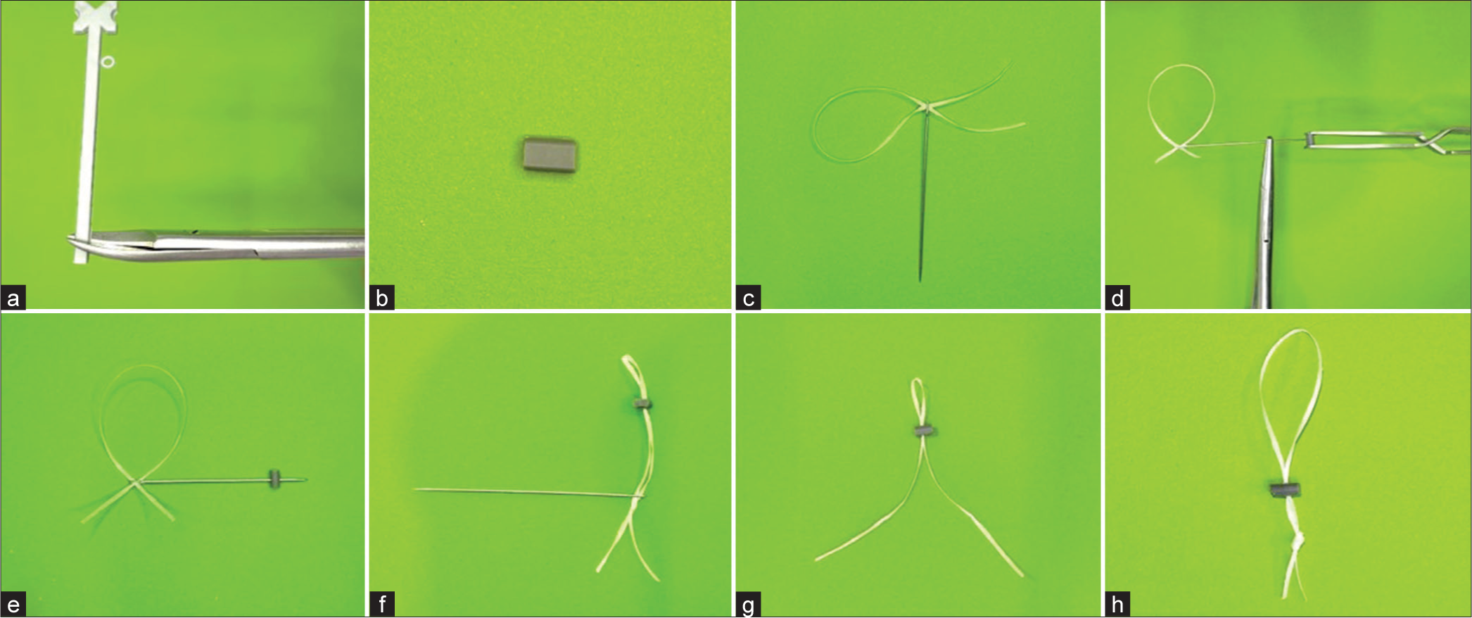 (a) Take a stem of elastomeric ligature ties and cut it into pieces of about 4-mm thickness with metal scissors. (b) Sectioned piece of the stem of elastomeric ligature ties. (c) Double thread a piece of dental floss about 4 inches through the eyehole of a needle. (d) Firmly take a grip on the needle with needle-holding forceps and sectioned elastomeric piece with a bracket holding tweezers. (e) Pierce the needle through the elastomeric piece. (f) Straighten the floss. (g) Remove the needle from the floss. (h) Tie the loose ends of the floss.